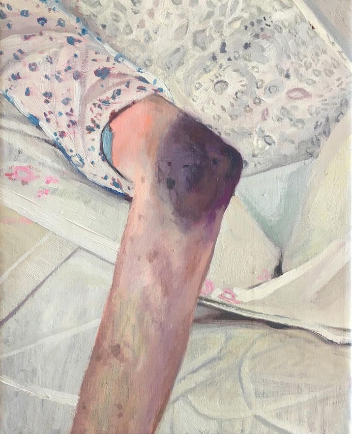 Peinture de Virginia Bersabé d'un coude d'une personne âgée