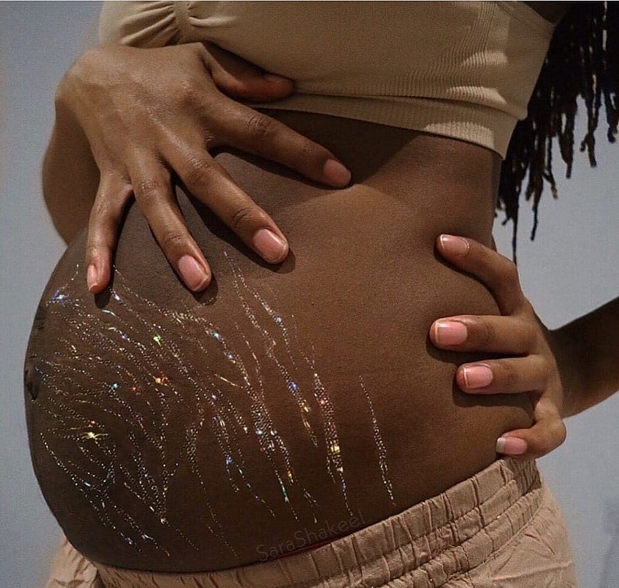 Femme enceinte avec des vergetures