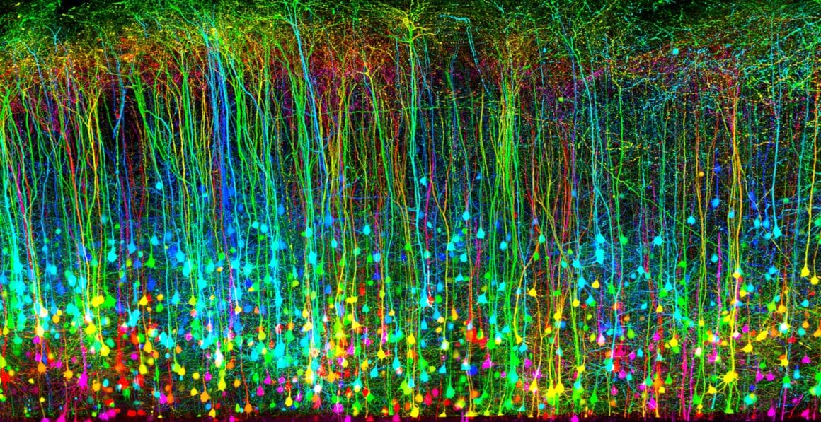 Traumatisme crânien d'une souris vu au microscope. Il forme des centaines de filaments "tombants" aux couleurs vives et fluorescentes.